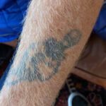 Foto av översida underarm, med urblekt svart tatuering föreställande en dödskalle genomstucken av en dolk.