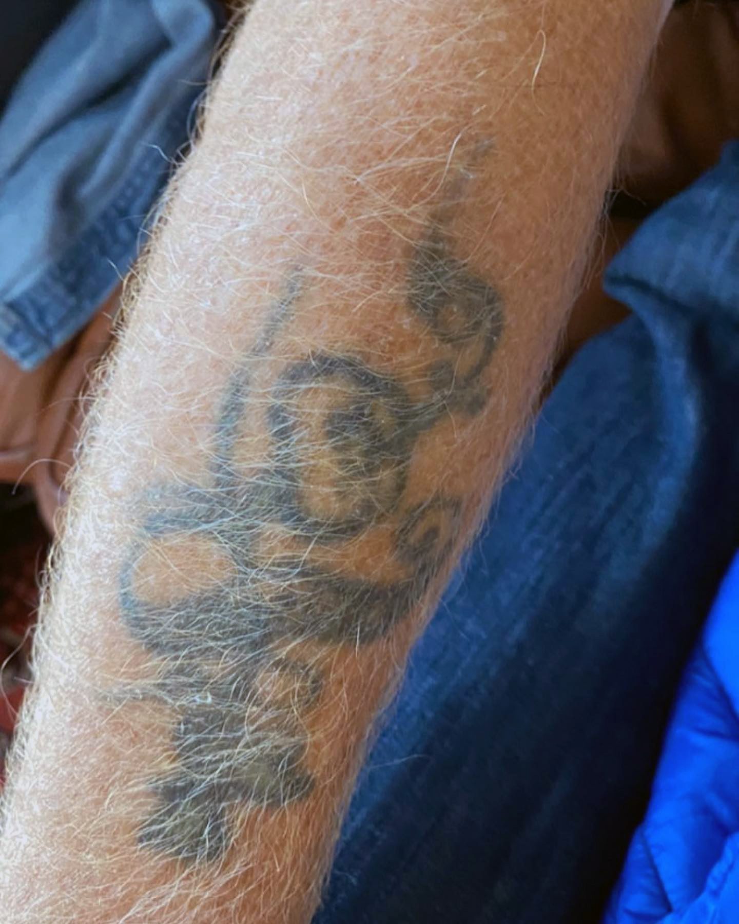 Foto av översida underarm med gråblek tatuering föreställande gissningsvis snirklig blomma med kringliggande, spiralformadbanderoll.